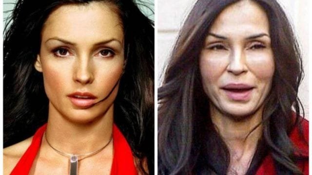 Famke Janssen Plastic Surgery