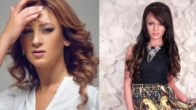 Yara Before Plastic Surgery