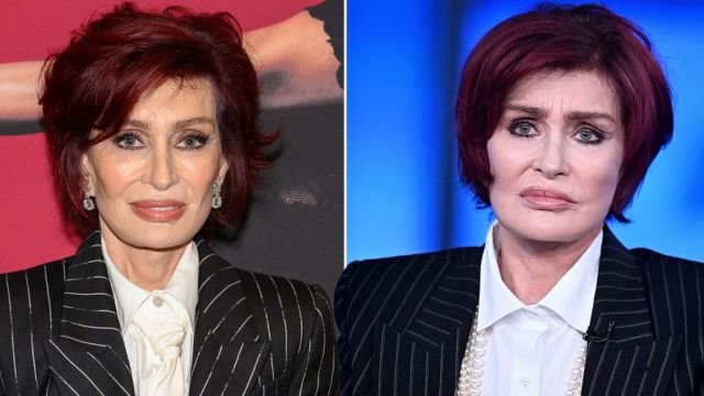 Sharon Osbourne Weight Loss