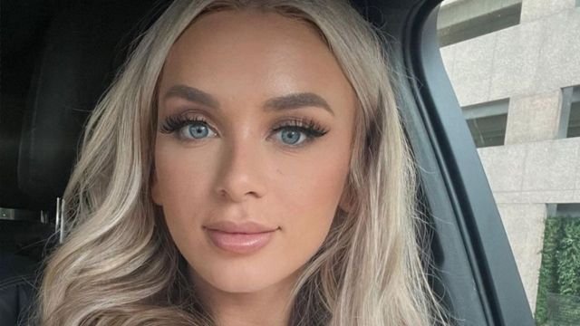 Yara Before Plastic Surgery