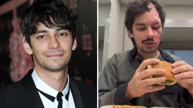 What Happened to Devon Bostick?