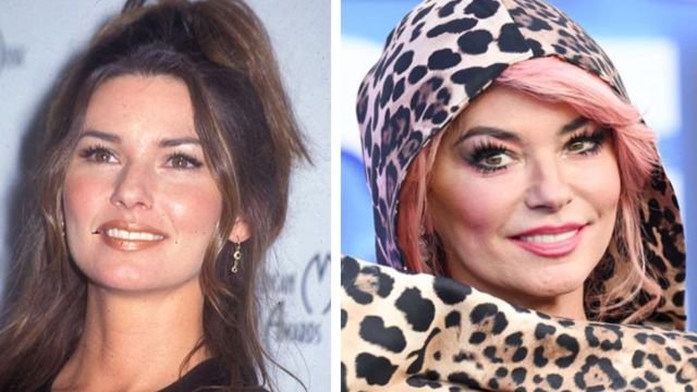 Shania Twain Plastic Surgery