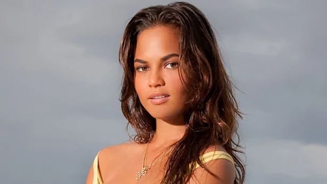 Chrissy Teigen Plastic Surgery