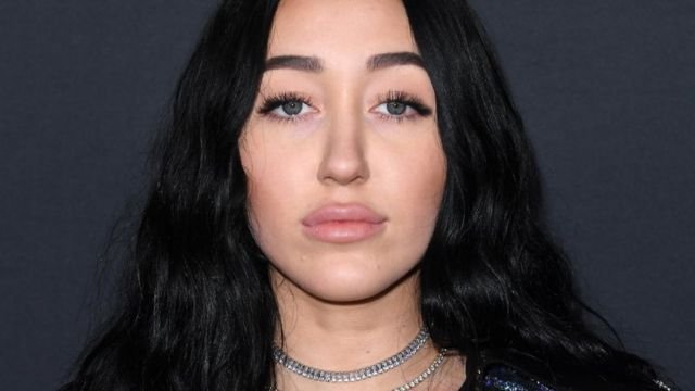 Noah Cyrus Plastic Surgery