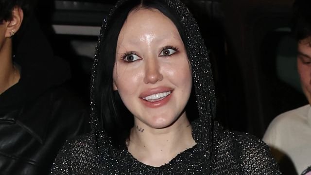 Noah Cyrus Plastic Surgery