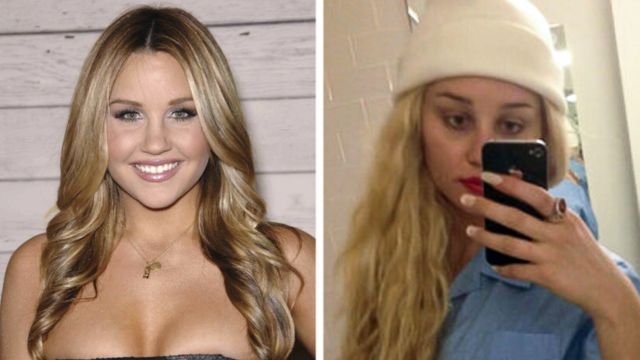 What Happened to Amanda Bynes?