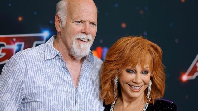 Reba McEntire Plastic Surgery